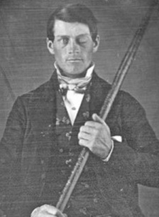 Phineas Gage com o seu varão de ferro
